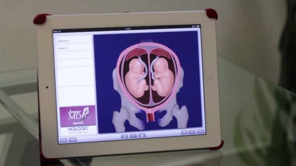 Μεξικό, 2014: κοντινό πλάνο χειρός. Γιατρός εξηγώντας μια εικόνα εμβρύου σε ένα δισκίο . — Αρχείο Βίντεο