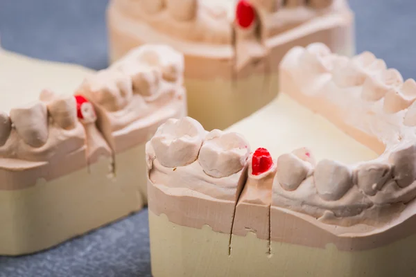 Moldes de dentes na mesa cinza — Fotografia de Stock