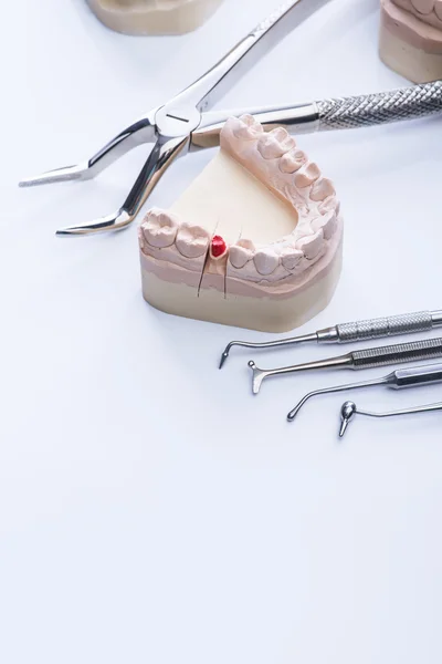 Zahnform und grundlegende zahnärztliche Werkzeuge auf weißem Tisch — Stockfoto