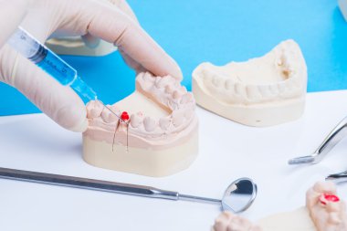 Diş hekimi nasıl enjeksiyon yapılacağını gösterir