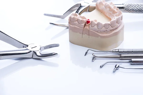 Tanden schimmel en tandheelkundige basisinstrumenten op witte tafel — Stockfoto
