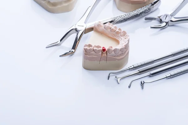 Molde de dentes e ferramentas odontológicas básicas na mesa branca — Fotografia de Stock