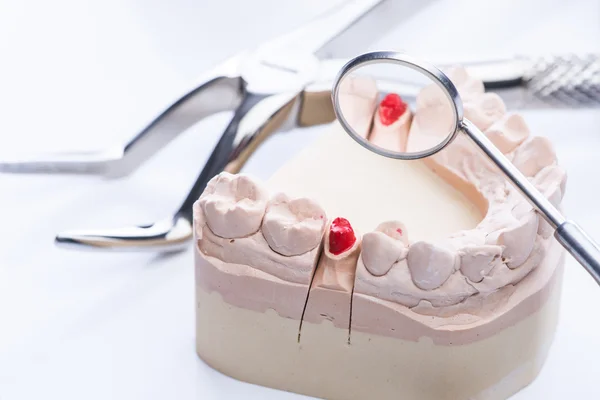 Stampo per denti e strumenti dentali di base su tavolo bianco — Foto Stock