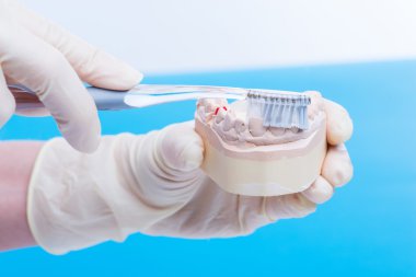 Diş hekimi nasıl dişleri temizlemek için gösterir