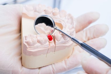 Diş hekimi examinates kalıp