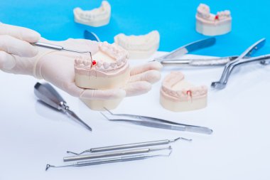 Diş hekimi examinates kalıp