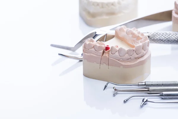 Molde de dientes y herramientas dentales básicas en mesa blanca — Foto de Stock