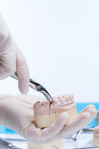 Belgische tandarts de tanden schimmel — Stockfoto