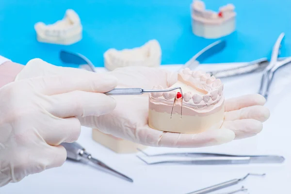 Dentista esamina la muffa dei denti — Foto Stock