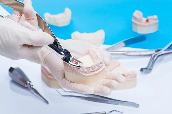 Dentista examina o molde dos dentes — Fotografia de Stock