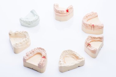Teeth molds on a bright white table clipart