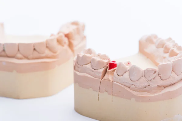 Tanden mallen op een helder witte tafel — Stockfoto
