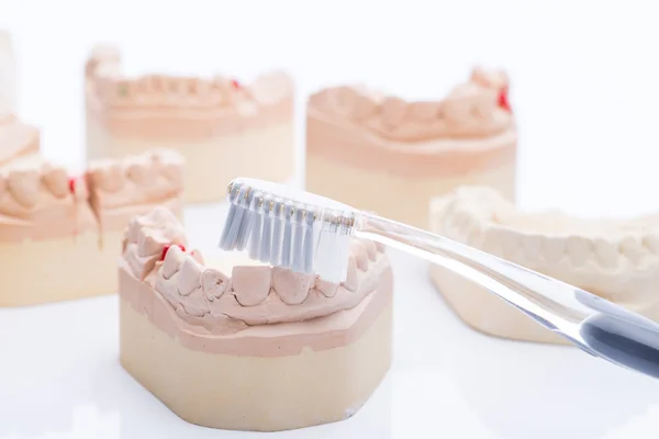 Moldes de dentes com escova de dentes em uma mesa branca brilhante — Fotografia de Stock