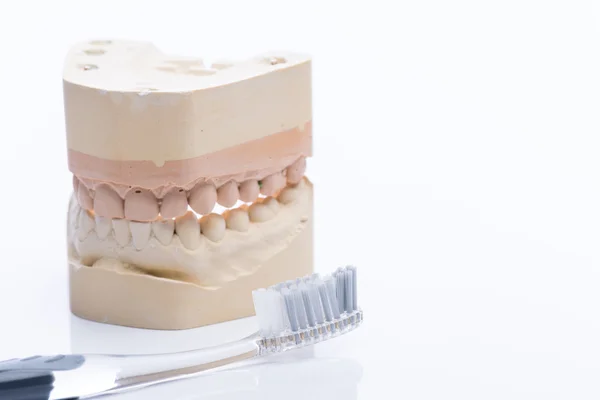 Moldes de dientes con cepillo de dientes sobre una mesa blanca brillante — Foto de Stock