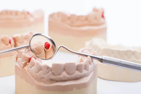 Moldes de dentes com ferramentas odontológicas básicas em uma mesa branca brilhante — Fotografia de Stock