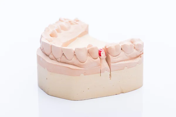 Teeth mold on a bright white table — Stock Photo, Image