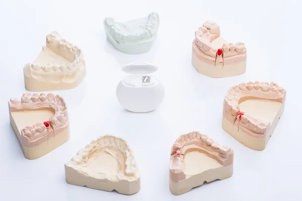 Moldes dentales con hilo dental sobre una mesa blanca brillante — Foto de Stock