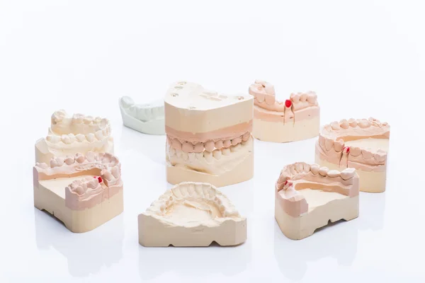 Moldes de dentes em uma mesa branca brilhante — Fotografia de Stock