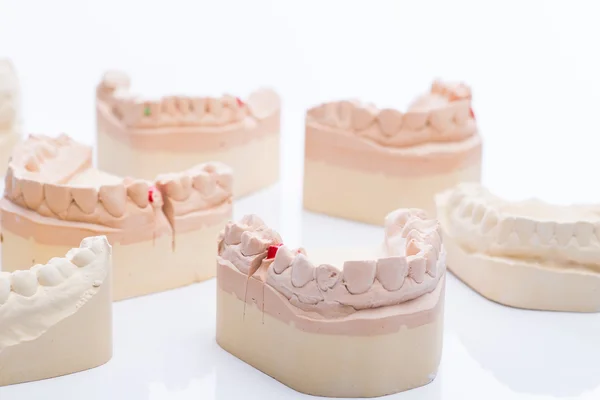 Tanden mallen op een helder witte tafel — Stockfoto
