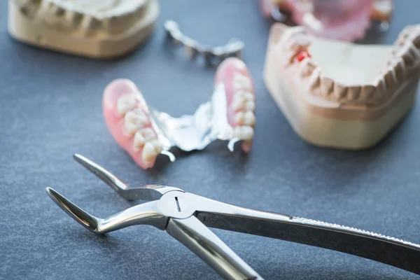 Kunstmatige vervanging tanden met een tang op een donkere tafel — Stockfoto