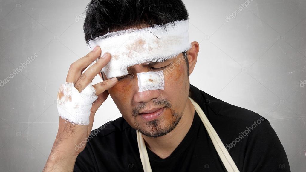 Injured man expressing head trauma concept Stock Photo by ©PepscoStudio