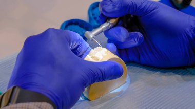 Diş teknisyeni diş protezleriyle çalışıyor. Görüntüyü kapat.