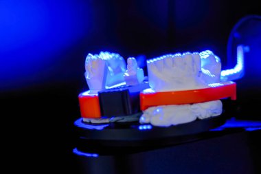 Diş alçı taşı modeli taraması ve ölçümü için 3D diş tarayıcı - kapat