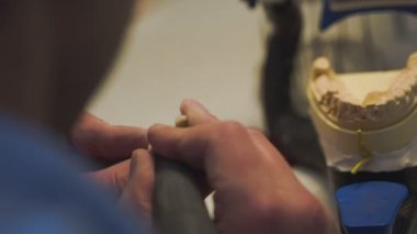 Diş hekimi protez ile çalışma laboratuarda implantları. Yakın çekim.