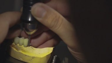 Diş hekimi protez ile çalışma laboratuarda implantları. Yakın çekim.