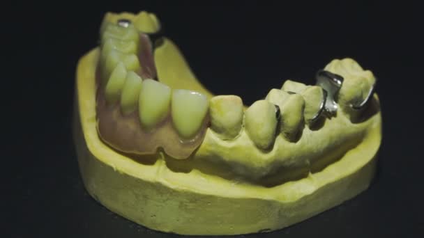 Vue rapprochée de la prothèse prête 2 