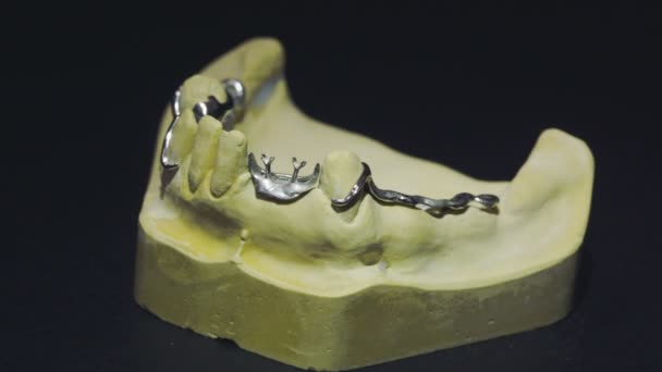 Vue rapprochée de la prothèse prête 3 