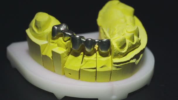 Vista de cerca de la prótesis dental lista 4 — Vídeos de Stock