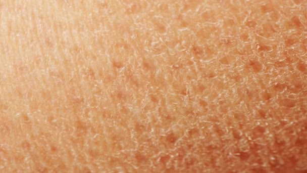 乾燥した かすかな色素の肌と明るい肌のプロセス — ストック動画