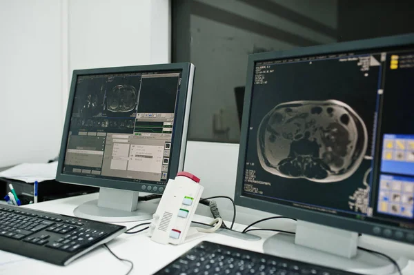 医学的テーマ 病院の診断Mriセンター それに人間の脳を持つコンピュータのモニター — ストック写真