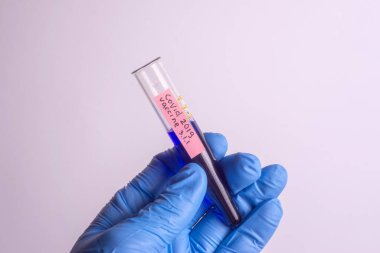 Doktor bilim adamı elinde Coronavirus 'a karşı aşının bir çeşidini içeren bir test tüpü tutuyor.