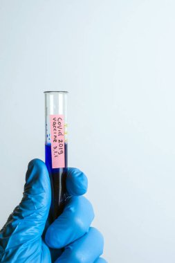 Doktor bilim adamı elinde Coronavirus 'a karşı aşının bir çeşidini içeren bir test tüpü tutuyor.