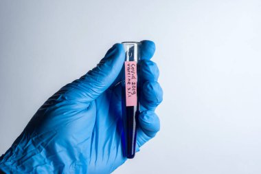 Doktor bilim adamı elinde Coronavirus 'a karşı aşının bir çeşidini içeren bir test tüpü tutuyor.