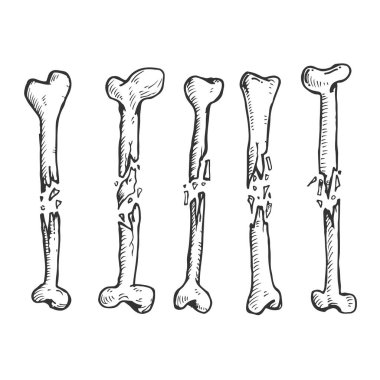 Kırık kemikler el yapımı vintage tarzında. Beyaz arkaplanda izole edilmiş vektör çizimi.