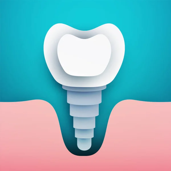 Ludzka Sylwetka Implantu Zęba Nowoczesnym Kreatywnym Stylu Minimalistyczna Koncepcja Wzornictwa — Wektor stockowy