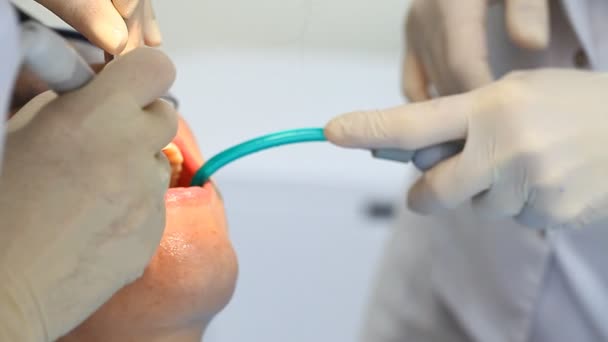 Diş hekimi yordamı bir hasta yapar. — Stok video