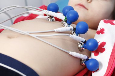 EKG ölçüm için tıbbi malzeme