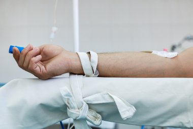 İşlem sırasında kol patent