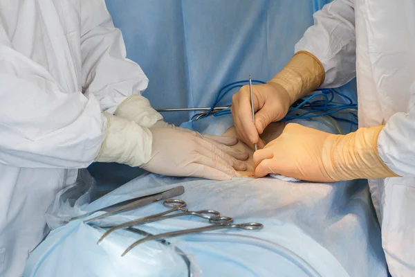 Surgeon's hand during operation — Stok fotoğraf