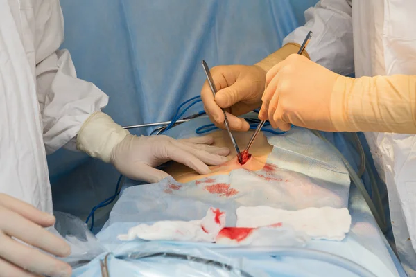 Surgeons operate — Stok fotoğraf