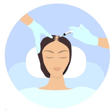 Dişi kellik tedavisi bilgi grafikleri. Meso terapi ve saç büyütme stimülasyonu. Vektör çizimi. - Vektör illüstrasyonu