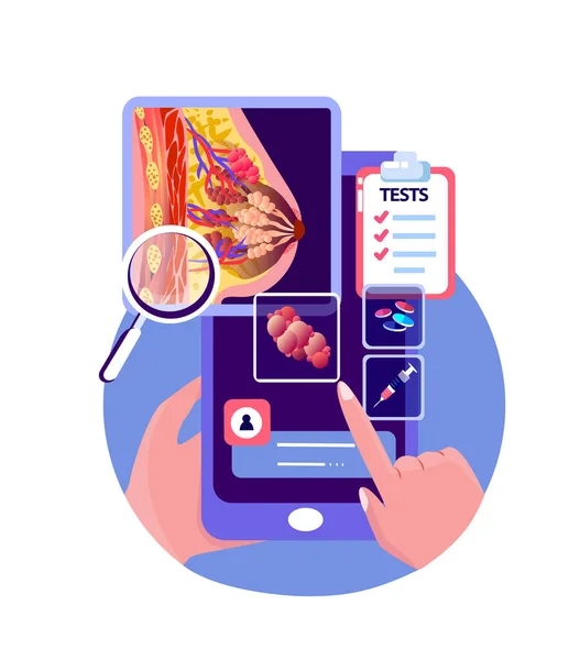 Online Touchscreen Hastanesi Lakteal Bez Kanser Şişmesi Kadın Göğüs Mobil — Stok fotoğraf