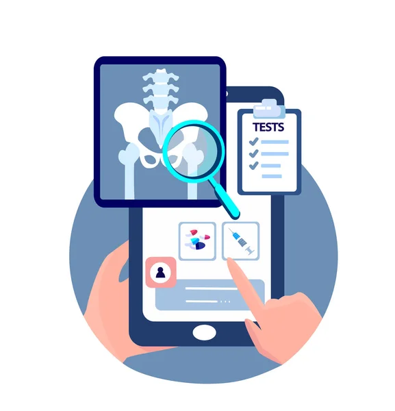 Online Touchscreen Traumatologie Orthopedie Mobiele Toepassing Smartphone Ray Radiografie Hip — Stockvector