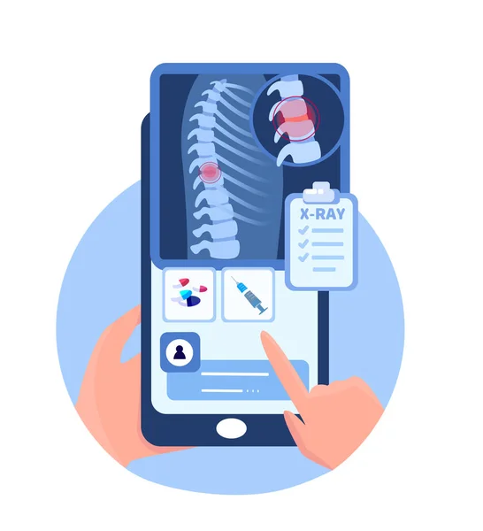 Online Touchscreen Vertebrologie Orthopädie Mobilanwendung.Smartphone Röntgen Röntgenaufnahme, Schmerzen in der Wirbelsäule und Bandscheibenvorfall, Osteochondrose, Rontgen Tests.Internet Diagnose.Vektorillustration — Stockvektor