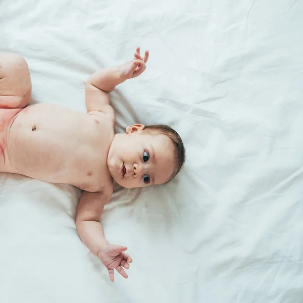 Ζύμη Εξάνθημα Στην Κοιλιά Ενός Νεογέννητου Μωρού Που Βρίσκεται Στο — Φωτογραφία Αρχείου