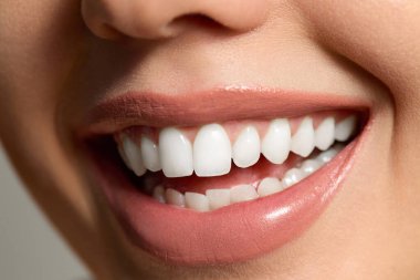 Sağlıklı dişlerini ve ışıl ışıl tenini sergileyerek kaplıcada cilt bakımının keyfini çıkaran bir kadın. Doğal ışık tazelik katar.